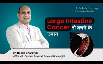 Tips to prevent colon cancer