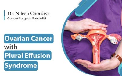 Ovarian Cancer with Pleural Effusion Syndrome