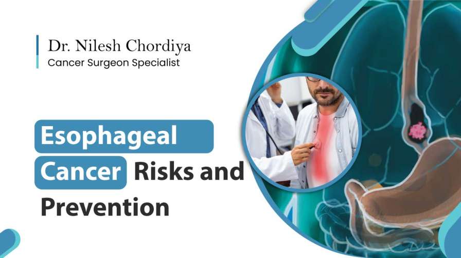 Esophageal Cancer Risks and Prevention