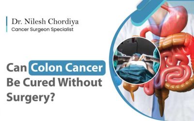 Can Colon Cancer Be Cured Without Surgery?