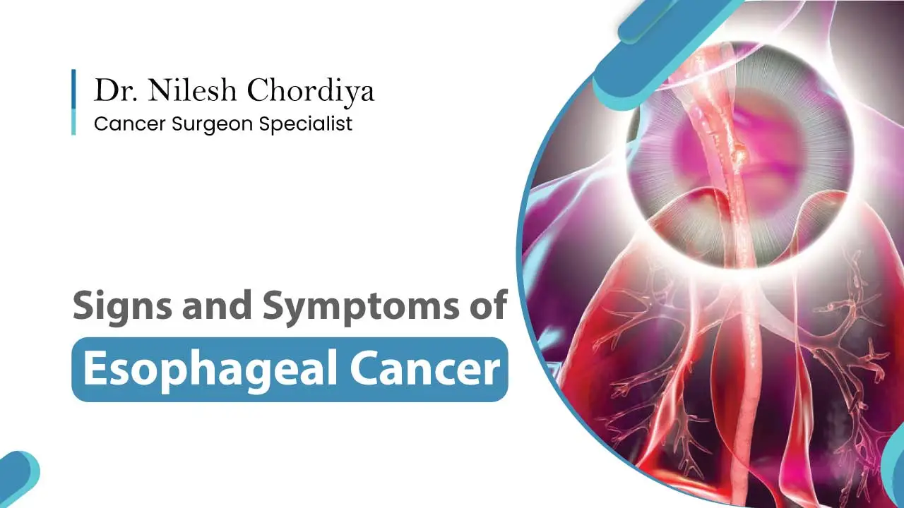 esophageal cancer symptoms .