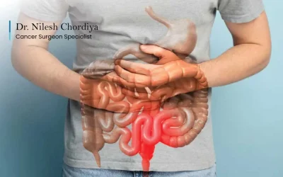 Does Colorectal Cancer Cause Diarrhea?